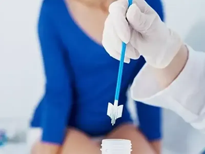 آزمایش پاپ اسمیر چیست؟