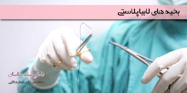 بخیه های لابیاپلاستی - دکتر صنم ساسان