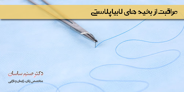 بخیه ها بعد از لابیاپلاستی - دکتر ساسان 