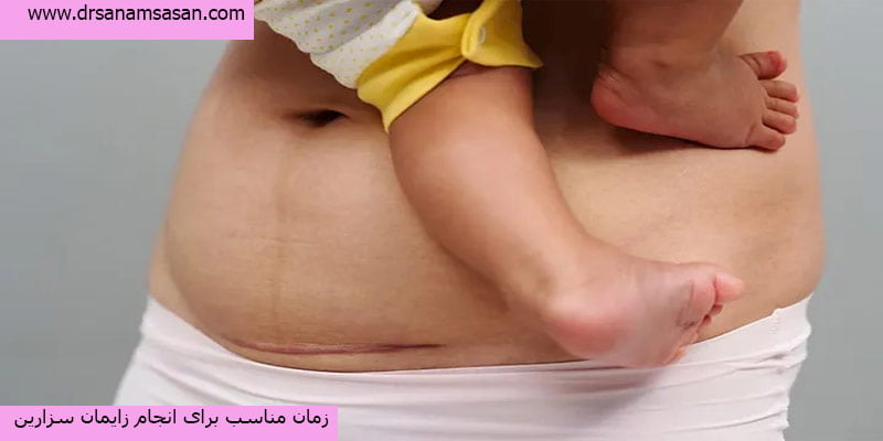 زمان-مناسب-برای-انجام-زایمان-سزارین
