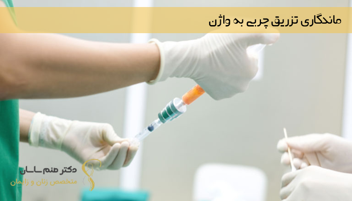 ماندگاری تزریق چربی به واژن 