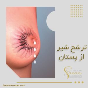 ترشح شیر از پستان + دکتر صنم ساسان