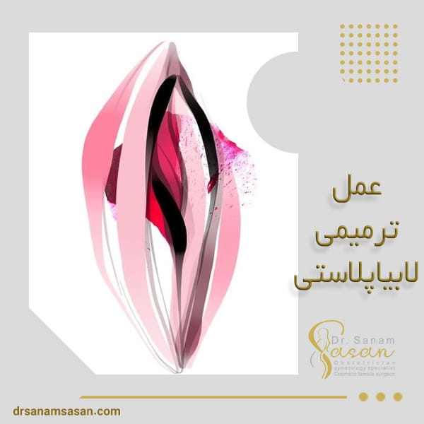 عمل ترمیمی لابیاپلاستی - دکتر صنم ساسان