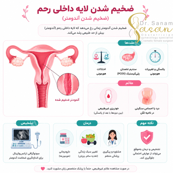 درمان ضخیم شدن دیواره رحم در تهران با دکتر صنم ساسان