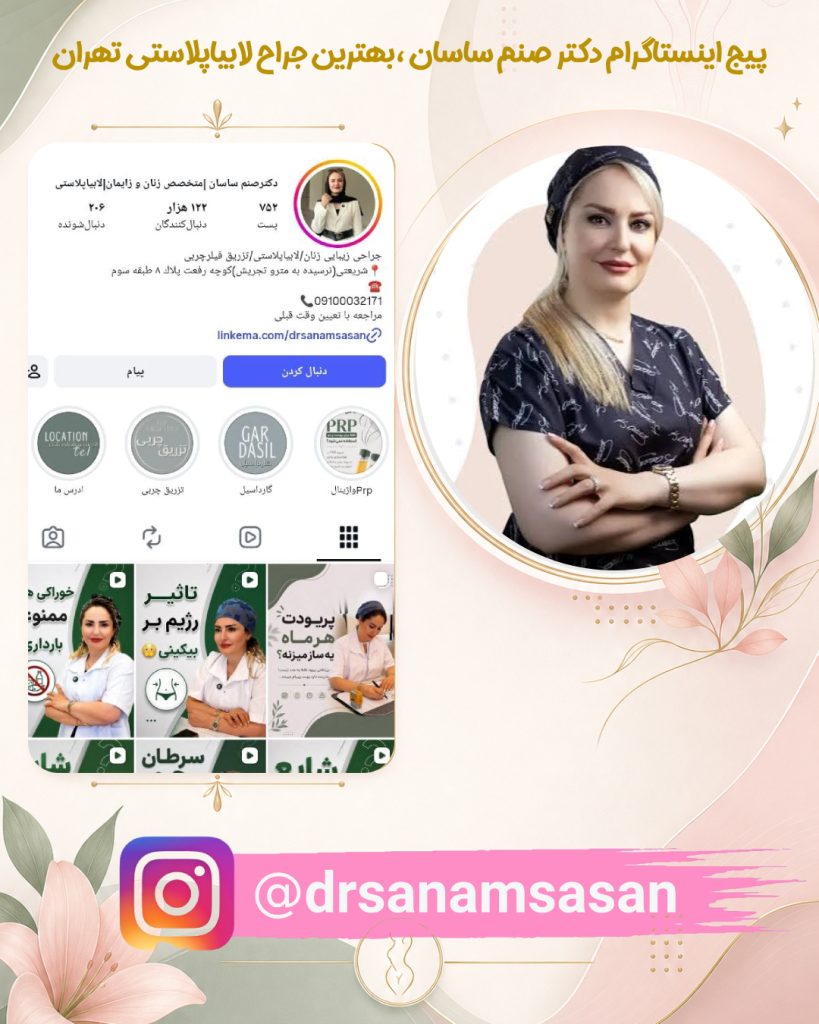 پیج اینستاگرام بهترین جراح لابیاپلاستی در تهران ، دکتر صنم ساسان