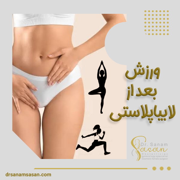ورزش بعد از لابیاپلاستی - دکتر صنم ساسان