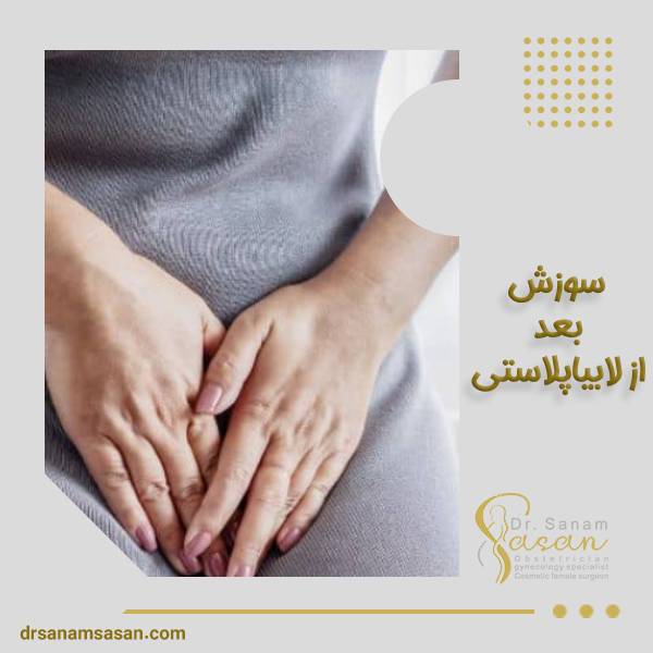 سوزش بعد از لابیاپلاستی