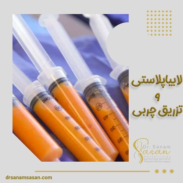 تزریق چربی و لابیاپلاستی
