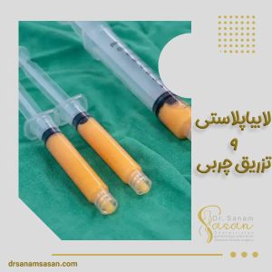 تزریق چربی و لابیاپلاستی
