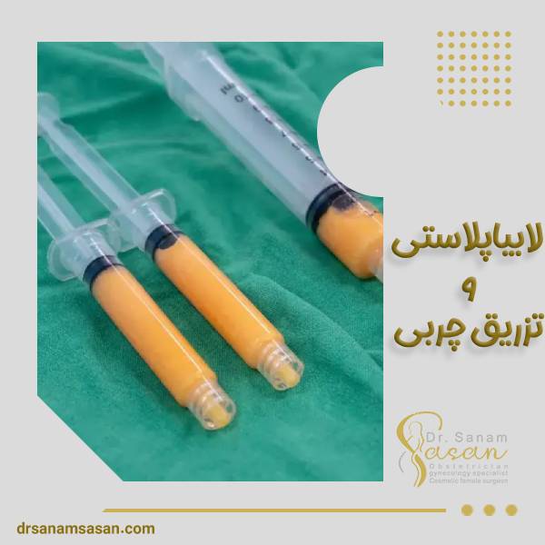 تزریق چربی و لابیاپلاستی