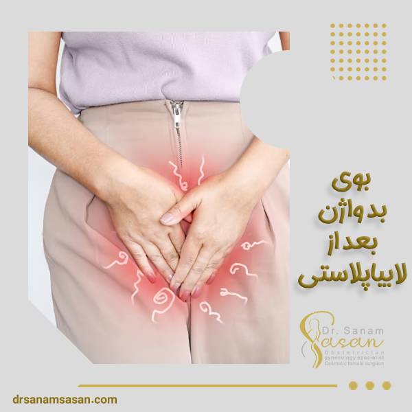 بوی بد واژن بعد از لابیاپلاستی